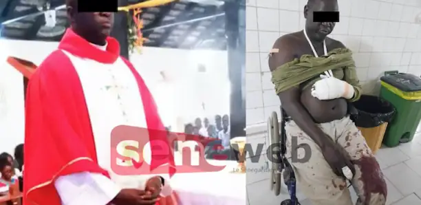 Dakar : Un prêtre sauvagement agressé à la machette